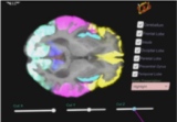 Picture of the project Brain 3D Anatomy