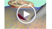Video of Dermal and Subdermal Incision Simulations